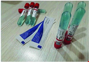 محیط انتقالی استوارت