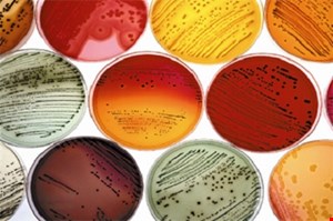 پلیت 8cm Mannitol/Dnase/blood