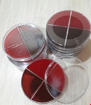 پلیت چهار قسمتی 10cm BA/EMB