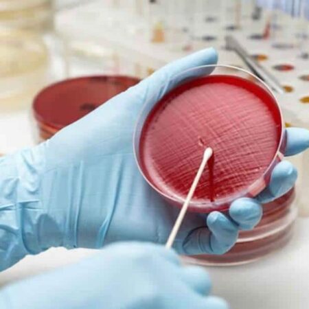 محیط کشت پلیت 6 سانت 1 خانه MSA