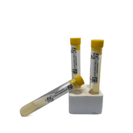 Sabouraud dextrose Tube